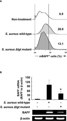Bacterial Lipoproteins Induce BAFF Production via TLR2/MyD88/JNK Signaling Pathways in Dendritic Cells